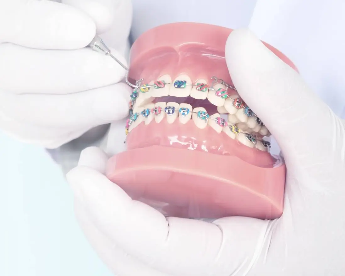 Especialista en Tratamiento de ortodoncia y ortopedia cerca de la colonia Gaviotas Norte Villahermosa Tabasco