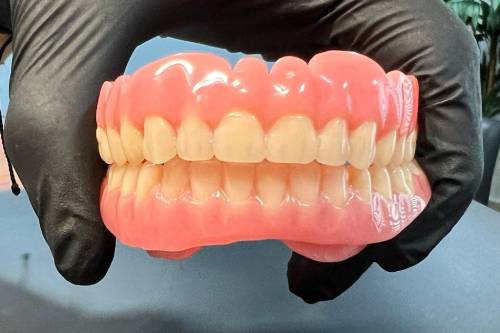 Prótesis removibles